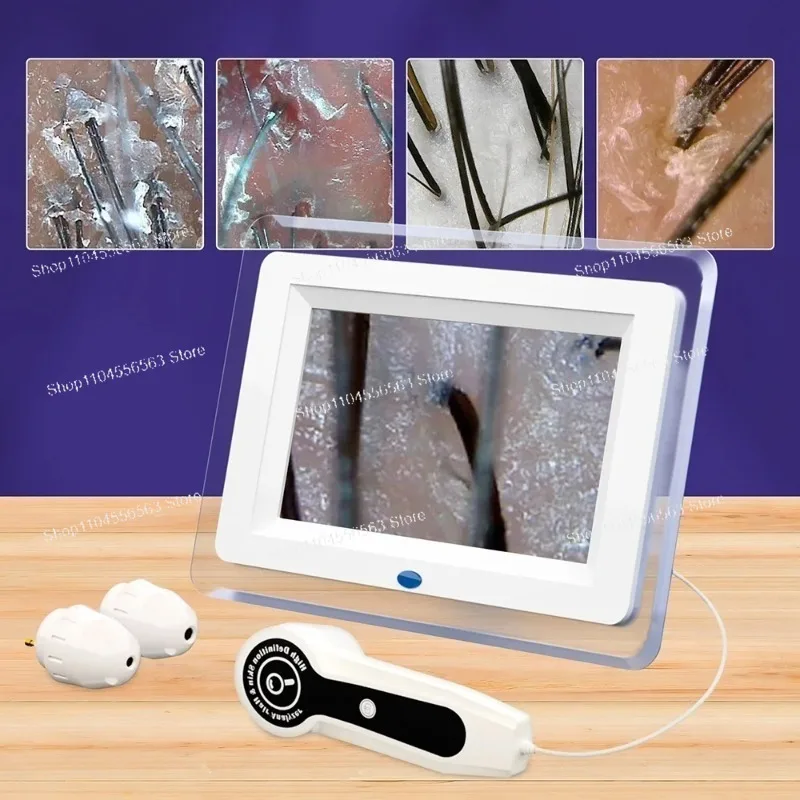 7 Inch LCD Scalp Detector Digital Hair Skin Analyzer Microscope 50/200X Magnifier for Follicle Test