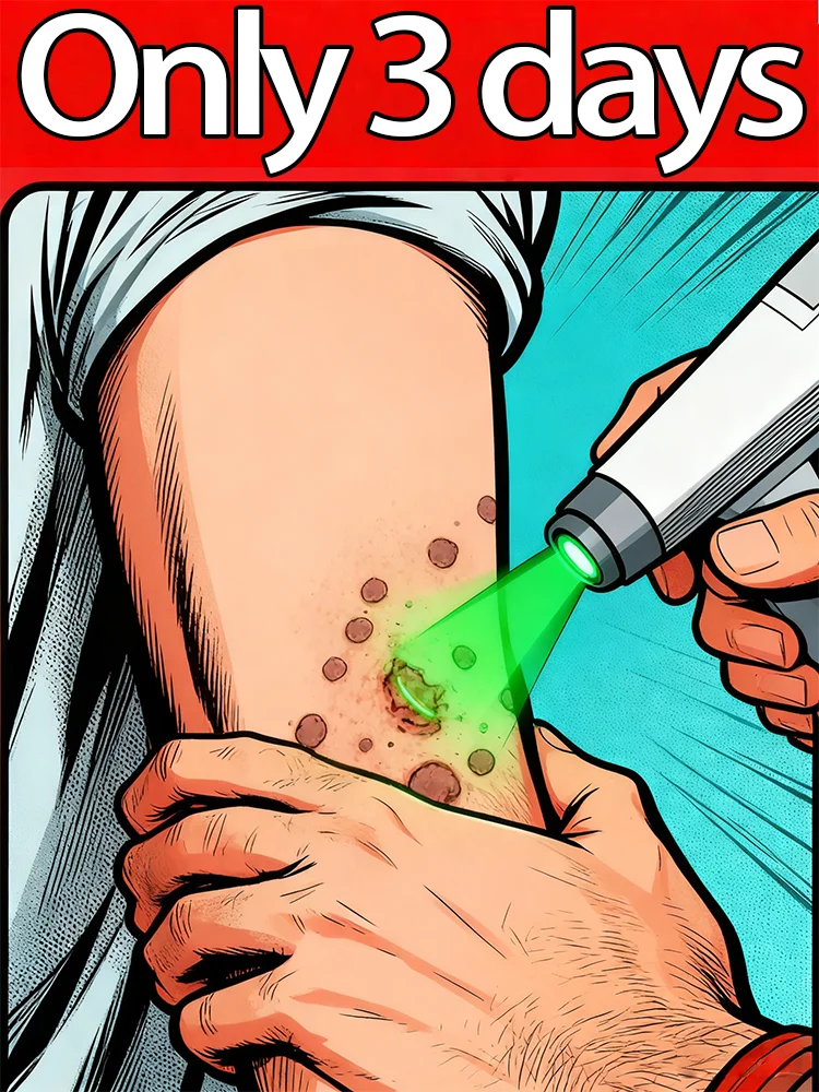 

Bᴇsᴛ-sᴇʟʟɪɴɢ ʙʟᴜᴇ ʟɪɢʜᴛ ᴡᴀʀᴛ ᴘᴇɴ, ʙᴏᴅʏ ᴡᴀʀᴛ ʀᴇᴍᴏᴠᴀʟ ᴛᴏᴏʟs