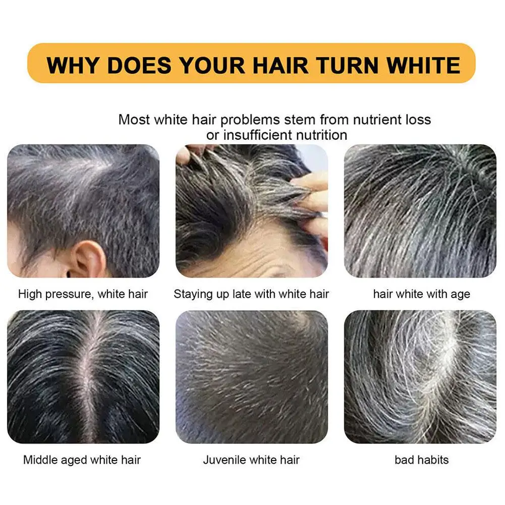 Sabonete De Shampoo De Carvão De Bambu, Limpeza Profunda, Fortalecimento Do Couro cabeludo, Produtos Para O Cabelo, Reparação A Seco, Prevenção, Perda Nutritiva, M6R8