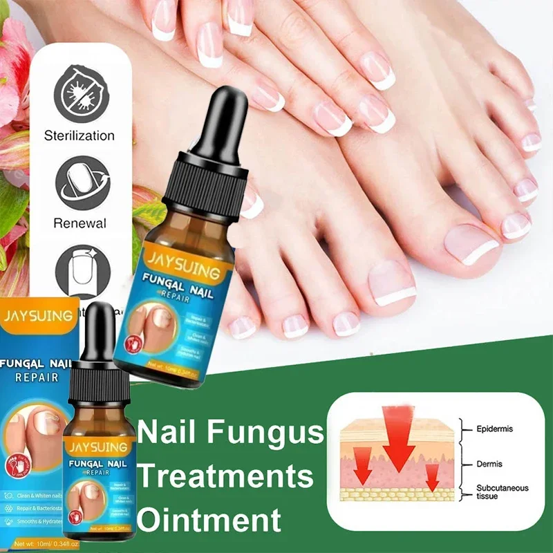 Nail Fungals Renewal Nail Repair Liquid for Discolored Thickened Crumbled Nails Nail Fungals for Discolored Broken Cracked