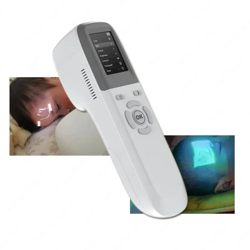 Medical Portable Infrared Vein Detector Vein Viewer Vein Finder Machine For Face