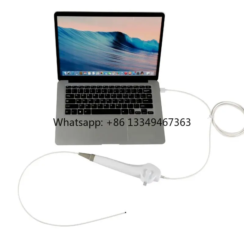

In Stock Medical Equipment Usb Rhinolaryngoscope hd Ent Endoscope Portable Endoscope System Hot Sale
