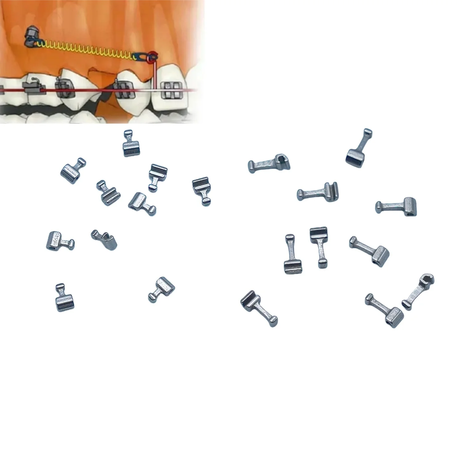 Ganchos crimpáveis dentais, tubo cruzado longo curto direita/esquerda de aço inoxidável, multifuncional, durável, fácil de usar, ferramentas ortopédicas com 10 unidades/pacote