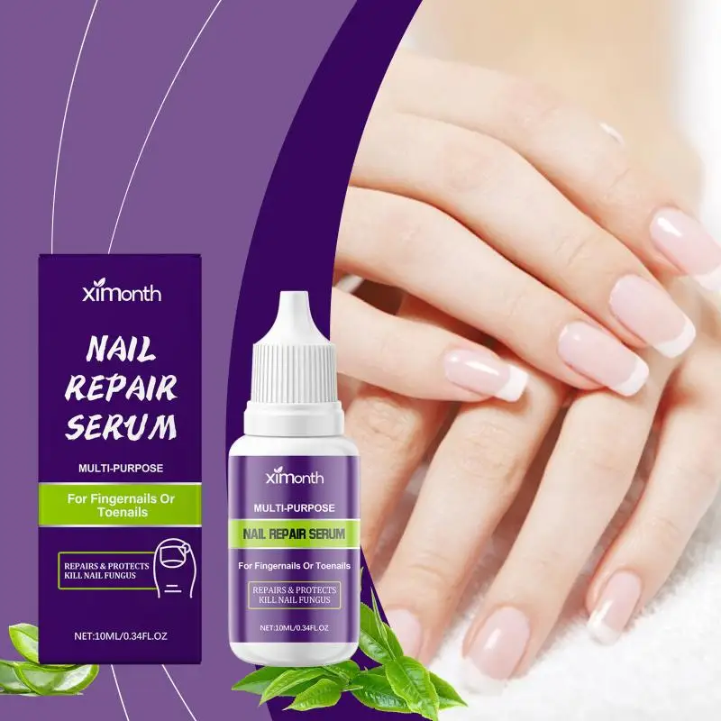 Nail Repair Serum Moisturizing Nourishing Relievesthe Dry Nails Improves Nail Elasticity Reduces Fragility For Daily Nail Care