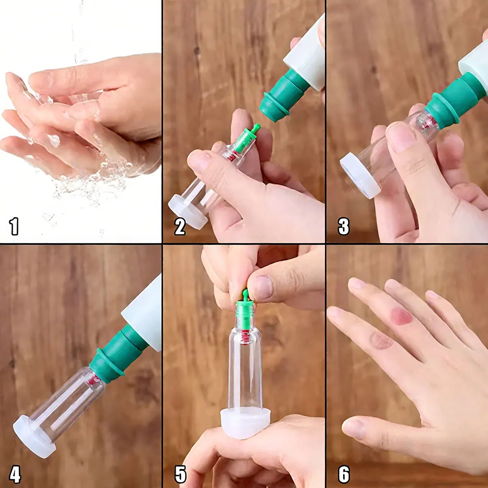 Chinese Medicine Plastic Cup Finger Jar Mouth Rubber Ring SiliconeFinger Massage Cupping Cup Health Vacuum Cans Cupping
