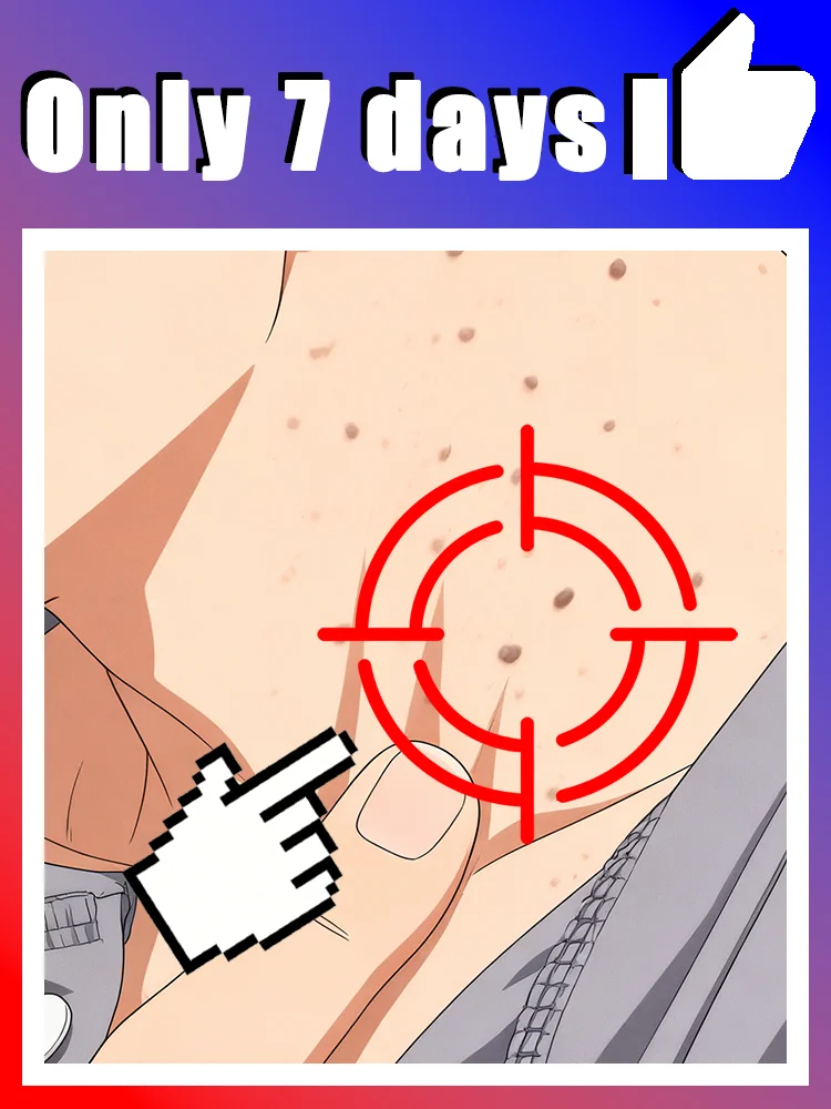 2025 nouvellement pour les verrues, faites votre vie moins de problèmes pour les verrues, outils pour le corps, livraison gratuite