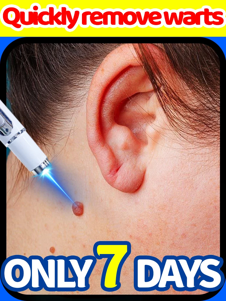 

Highly effective wart removal, professional-grade results, visible to the naked eye