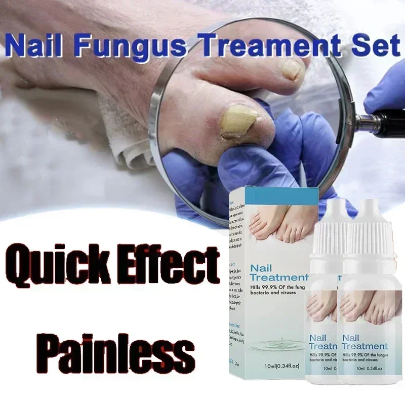 Anti Infection Paronychia Onychomycosis Nail Fungus Treatment Serum Toe Fungal Repair Products Hand Foot Care Removal Gel