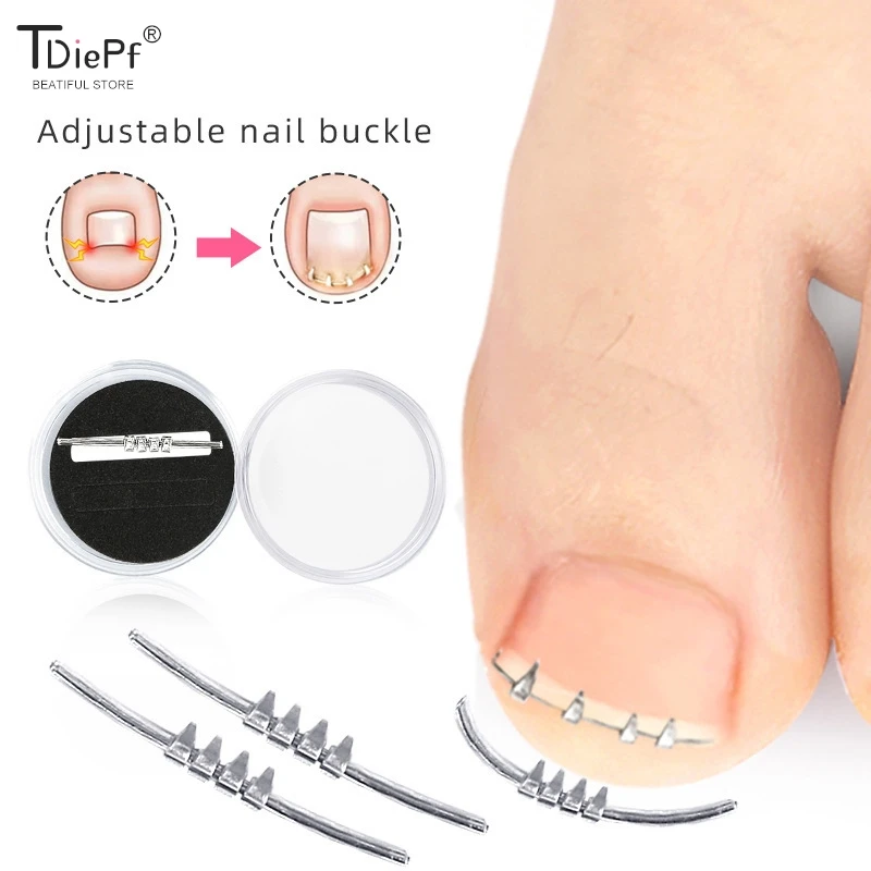 1PCS Ingrown Toenail Correction Tool Invisible Ingrown Toe Nail Elastic Straightening Clip Brace Pedicure Tool