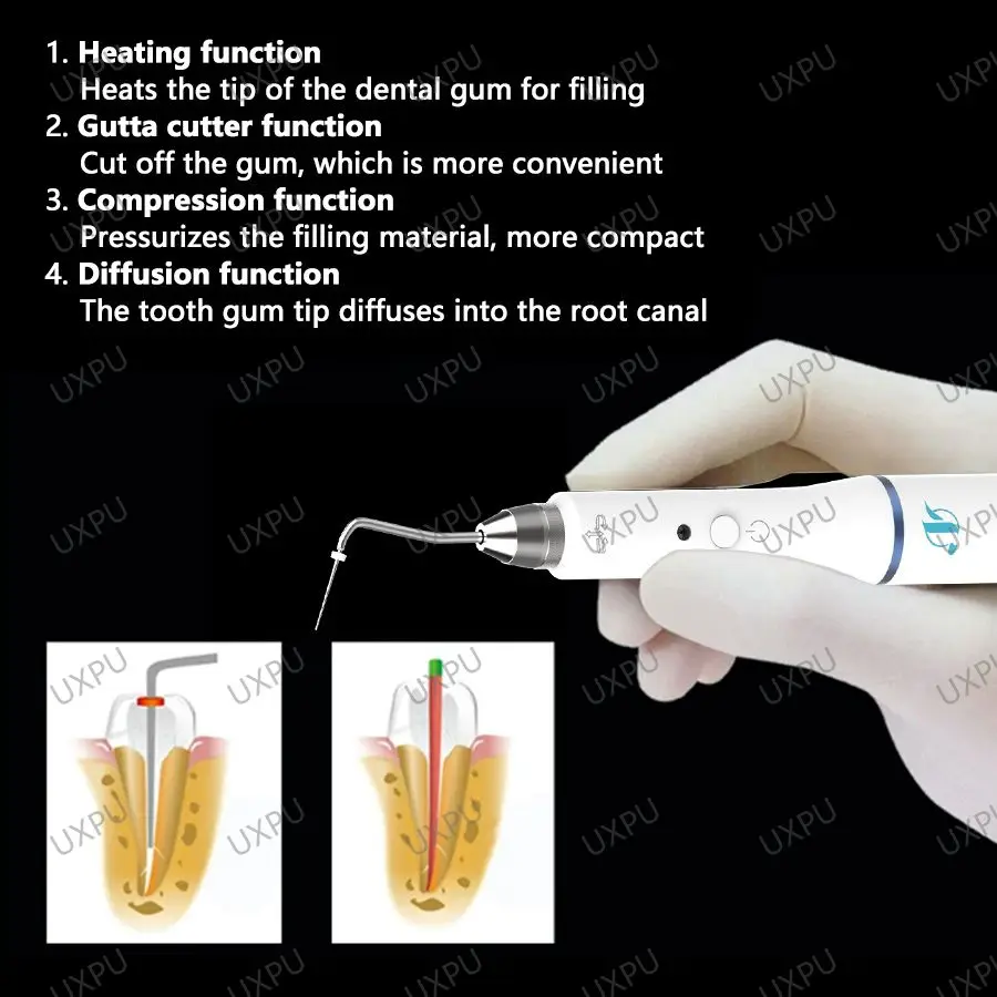 Bezprzewodowy system napełniania Uxpu Dental Gutta Percha Endo Podgrzewany długopis + 2-końcówkowy przyrząd do odontologii