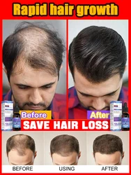 Hot selling product, 99% of buyers buy again, have more and more hair, say goodbye to baldness, thick hair.