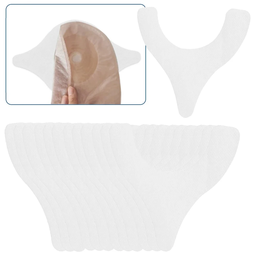 

20-60 шт. Y-образные клейкие уплотнительные полоски для стомированных мешков, удлинители для колостомных и илеостомных мешков, лента для стомы, мешок для стомы