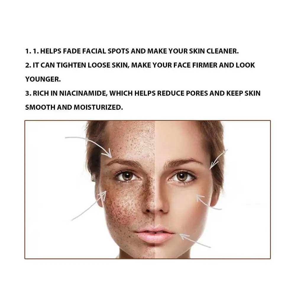 Niacinamide Remove Dark Spots Cream Whitening Freckle Moisturize Remove Effective Smooth Serum Melasma Brighten Skin Melani Q3a4