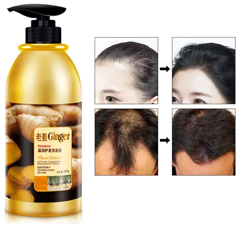 Herbal Ginger Hair Shampoo Hair Growth No Silicone Oil Control Anti Dandruff Itching Cleansing Professional Hair Treatment 400ml