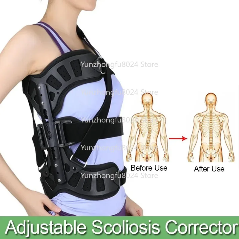 

Adjustable Scoliosis Posture Corrector Adults Health Support Brace Posture Corrector Scoliosis for Back Postoperative Recovery