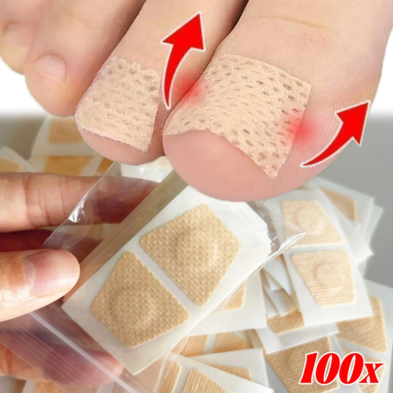 نام أظافر تو تصحيح ملصقات لاصق القدم مصحح باديكير قدم أدوات الرعاية الصحية منصات علاج الداحس الناعمة