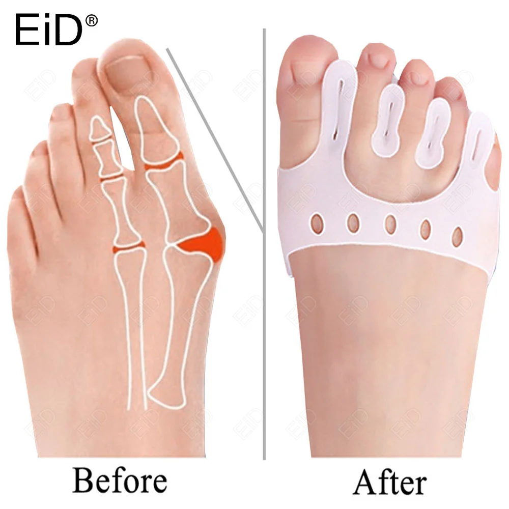 EiD Five Toe Separator Silicone Forefoot Pads Cushion Pad Pain Relief Shoes Insoles Finger Toe Hallux Valgus Corrector Gel Pads