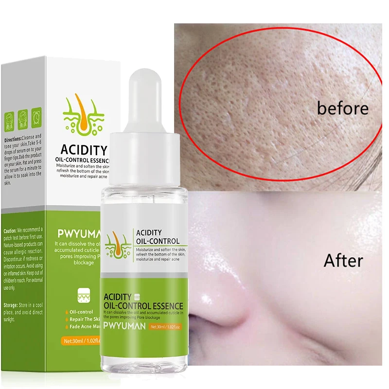 Lactic Acid Pore Shrink Face Serum Remove Blackheads Acne Oil Control Repair Gel Moisturizing Nourish Pores Firming Beauty Care