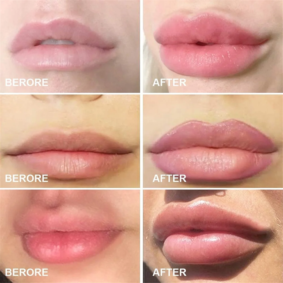 2 pezzi labbra potenziatore dispositivo carnoso labbra silicone forma di pesce naturale PoutMouth strumento sexyLip bocca