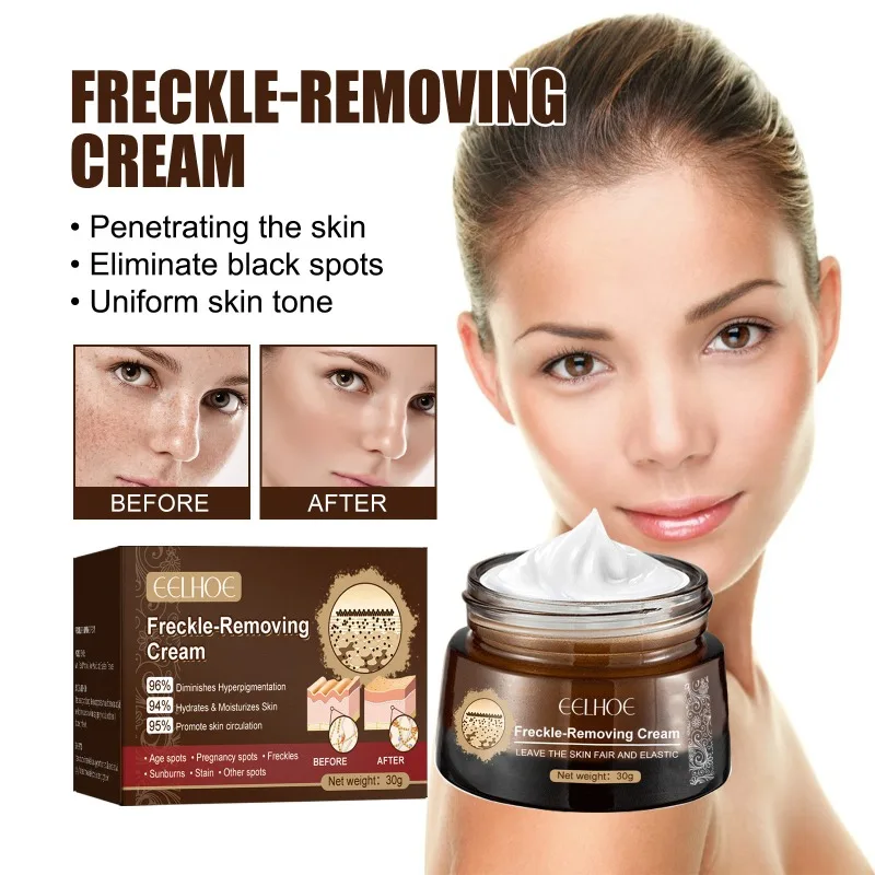 

30g Freckle-Removing Cream Effective Whitening Remove Dark Spots Melanin Melasma Remover Brighten Skin Anti-Aging Care Products