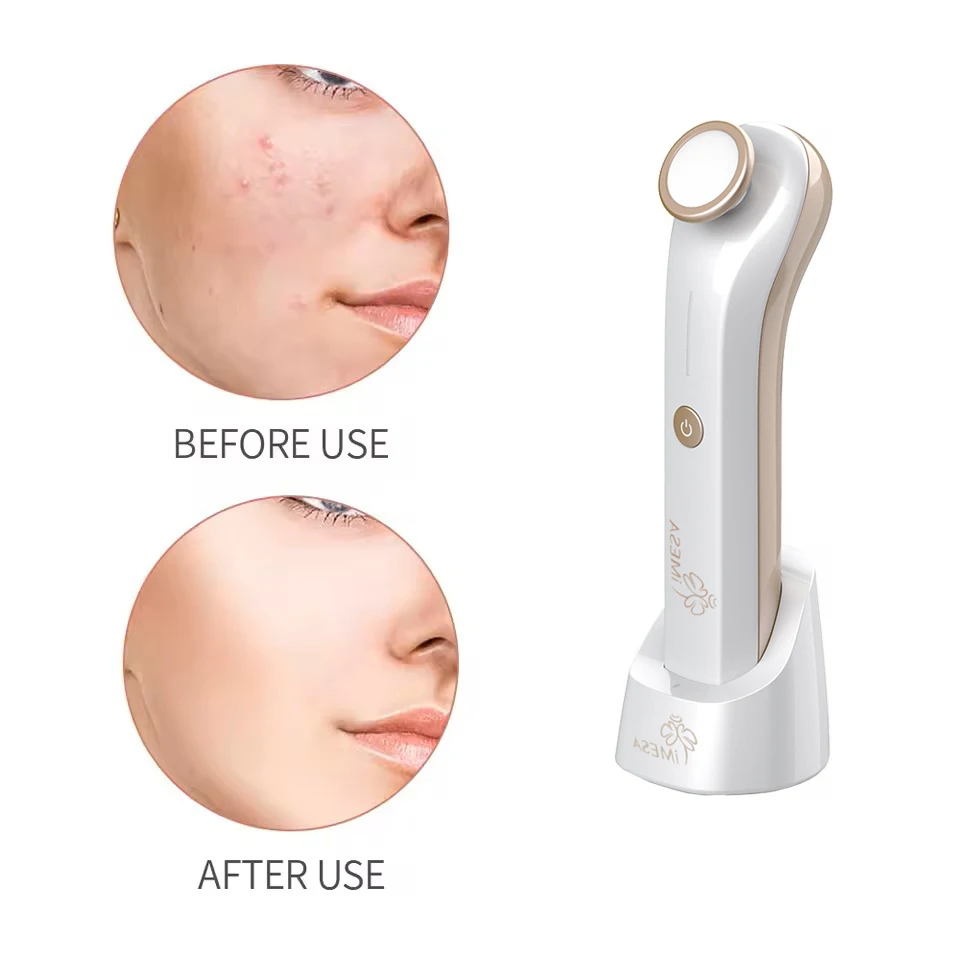 

IMESA Plasma Skin Care Beauty Machine Ozone Acne Remove Anti-acne Sterilization Skin Brightening Face Massagers Devices