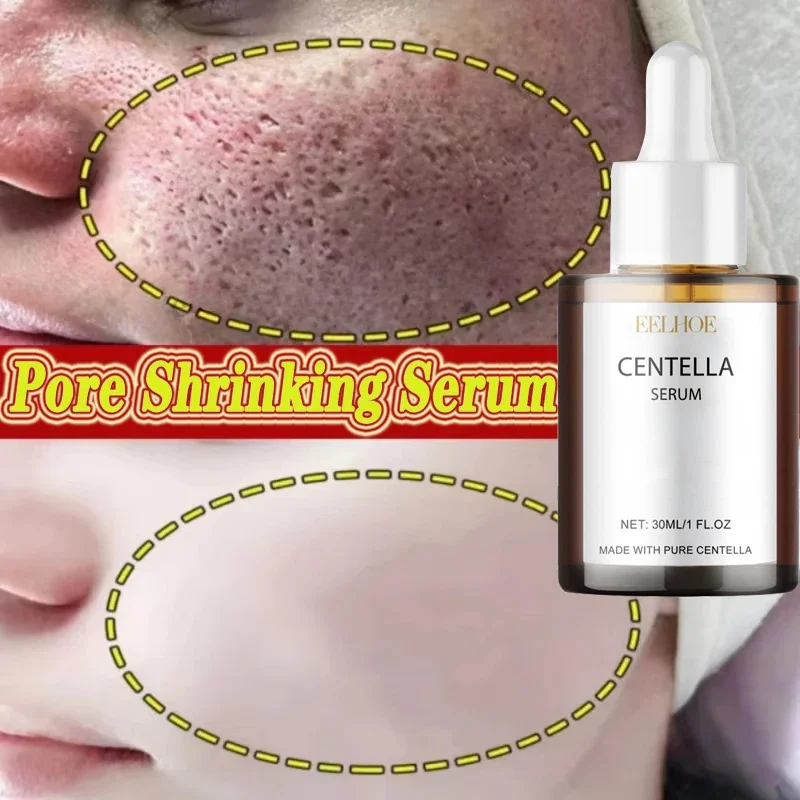 

Korean Centella Asiatica Face Serum Nourish Dry skin smoothing Rejuvenation Skin Brightening For Whitening Beauty Care Essence