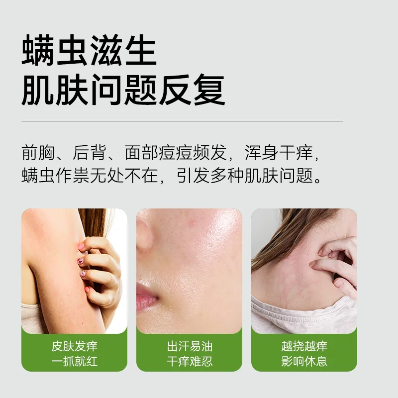 Manting anti-mite soap face and hand washing fragrance lasting acne removal oil control bath body