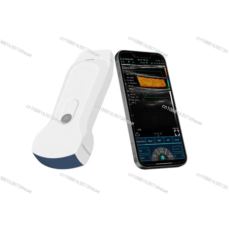 Wireless Wifi Ultrasound Scanner Probe  3 in 1 Color Portable Doppler Handheld Double Head Convex Usg Pocket