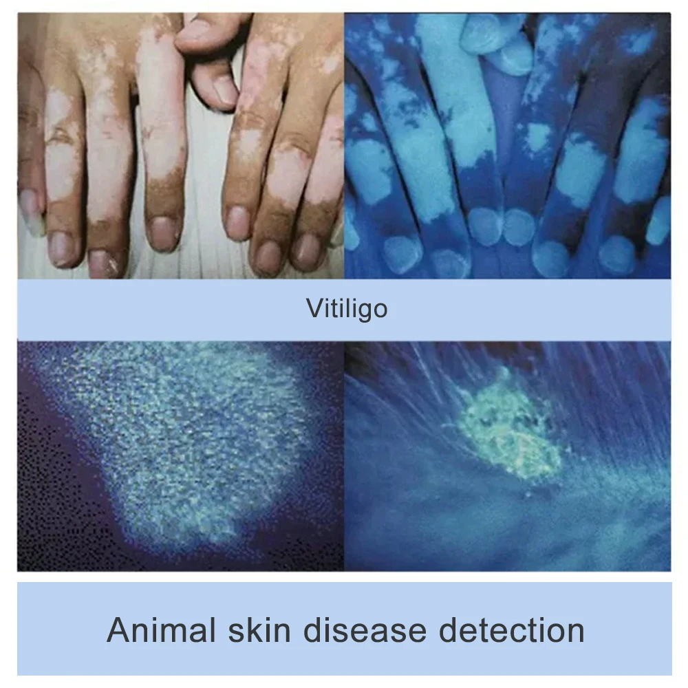 Animal cat ringworm detection Wood's lamp skin examination skin fungus detection vitiligo tinea versicolor chloasma Wood's lamp