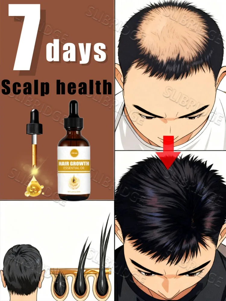 

Самые продаваемые средства по уходу за кожей головы для мужчин и женщин 2025 года, бесплатная доставка, унисекс