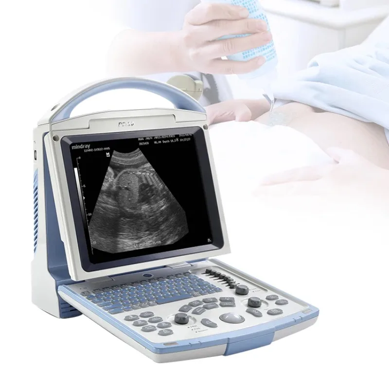 Mindray DP10 ultrasound machine laptop Mindray ultrasound portable ultrasound machine