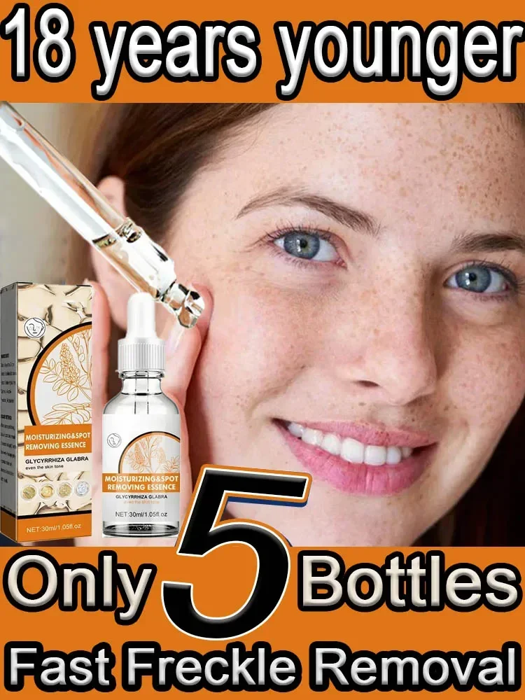 Freckle Removing Essence Whitening&Lightening Spot Essence Lighten Chloasma Replenish Water Beautify Skin Moisturizing Serum