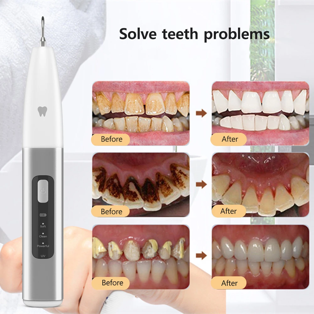 Limpiador Dental ultrasónico, eliminación de placa, eliminador de piedra Dental Sónica, ultrasonido para manchas de dientes, sarro y cálculo