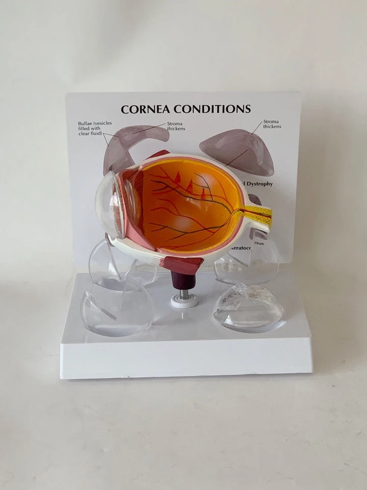 

Ophology Teaching Model Toy Visual Sensation Organs aract Glaucoma Retina Fundus Medical Eon Simulation Toy