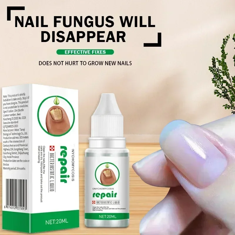 Nail Fungus Treatment Serum Toe Fungal Repair Products Hand Foot Care Removal Gel Anti Infection Onychomycosis Paronychia