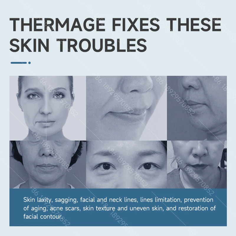 Professional Oligio X-ray Frequency Laser Non-invasive Anti-aging 6.78MHz Single-Pole Beauty Machine