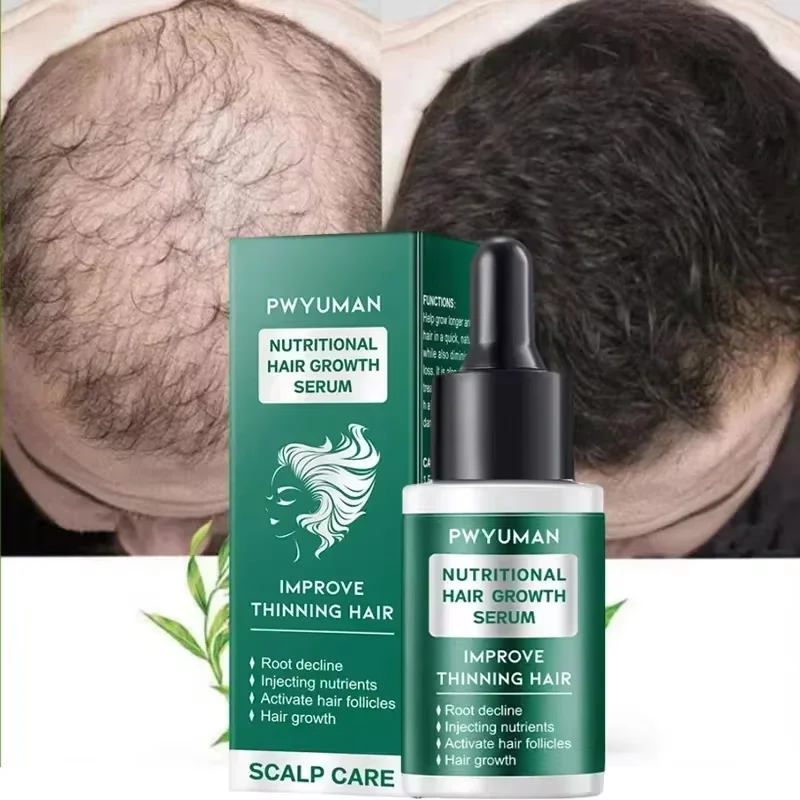 

7 Days Ginger Hair Growth Serum Fast Promote Hair Regrowth Products Anti Hair Loss Repair Scalp Baldness Nourish Hair Root Care