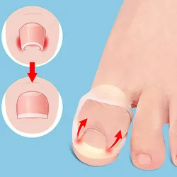 Strumento di correzione dell'unghia incarnita in Silicone protezione lisciante per unghie incarnite invisibile durevole riutilizzabile sotto gli strumenti di tensione