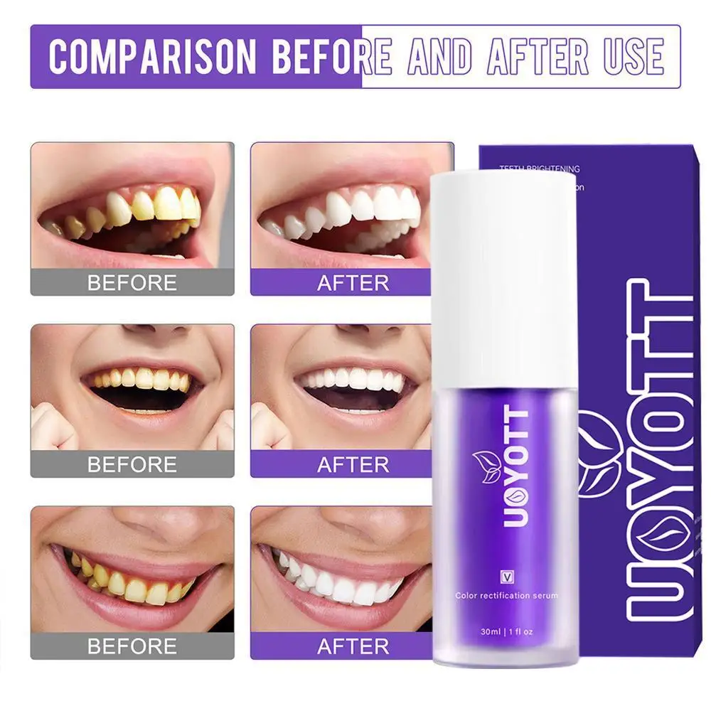 

UOYOTT V34 Purple Whitening Toothpaste Remove Smoke Stain Remove Stains Reduce Yellowing Care For Teeth Gums Fresh Breath