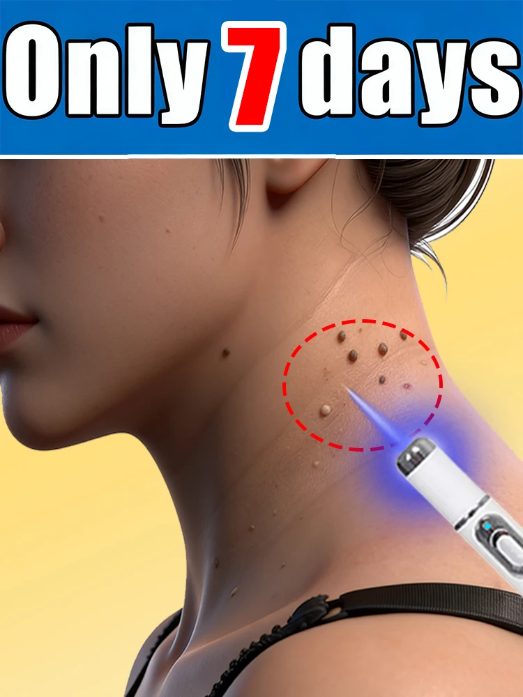 

Generation-2, бесплатная доставка по специальному предложению для успокаивающих проблем на коже. Портативный комплект унисекс с синей световой ручкой.