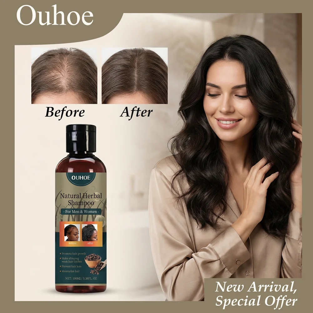 

Натуральный травяной шампунь OUHOE 100 мл, улучшает кровообращение кожи головы, укрепляет корни волос, с травяными ингредиентами, не вызывает раздражения.