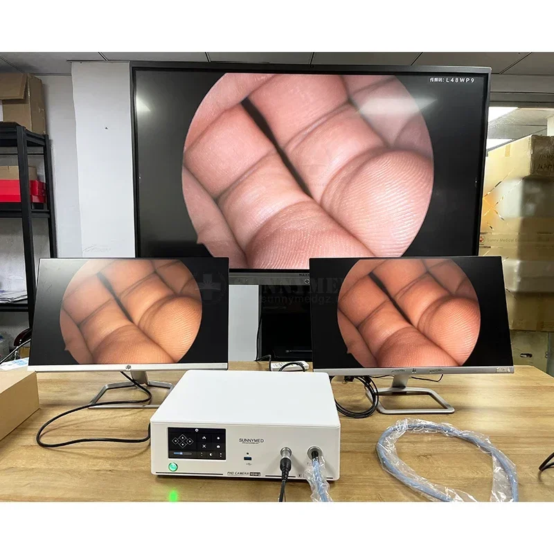 SY-PS048T 5인치 화면 및 광원 내시경 시스템을 갖춘 휴대용 풀 HD 4 in 1 데스크탑 내시경 카메라 시스템