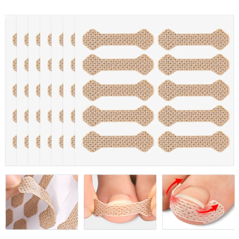 10Pcs/20Pcs/30Pcs Nail Correction Stickers Ingrown Toenail Corrector Patches Foot Care Tool Recover Corrector Pedicure Treatment