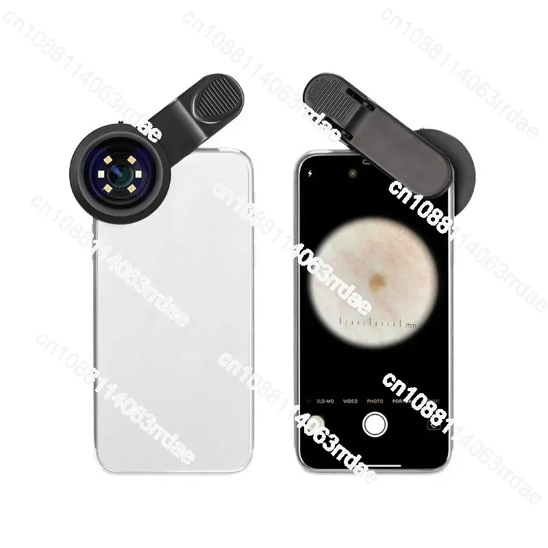 Portable Dermatoscope Magnifying Glass DE-300 Polarized and Non-Polarized Optical Dermatoscope