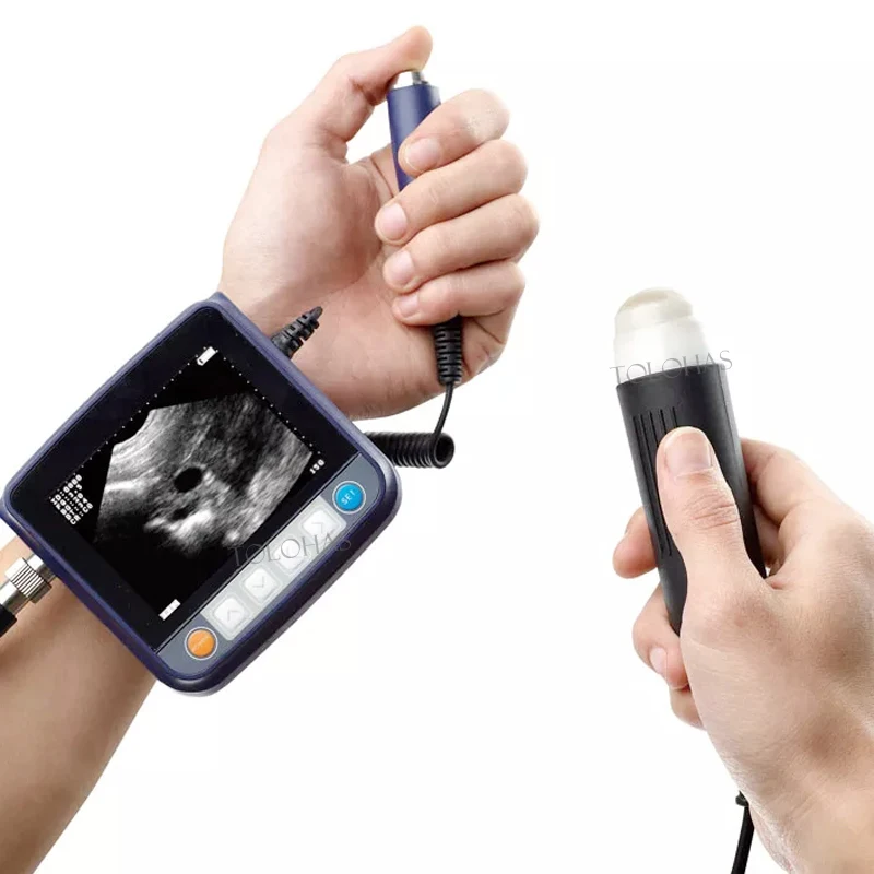 LHWV9 Small Size Portable Ultrasound Scanner Medical Farm Usg Veterinary Wrist Ultrasound Machine