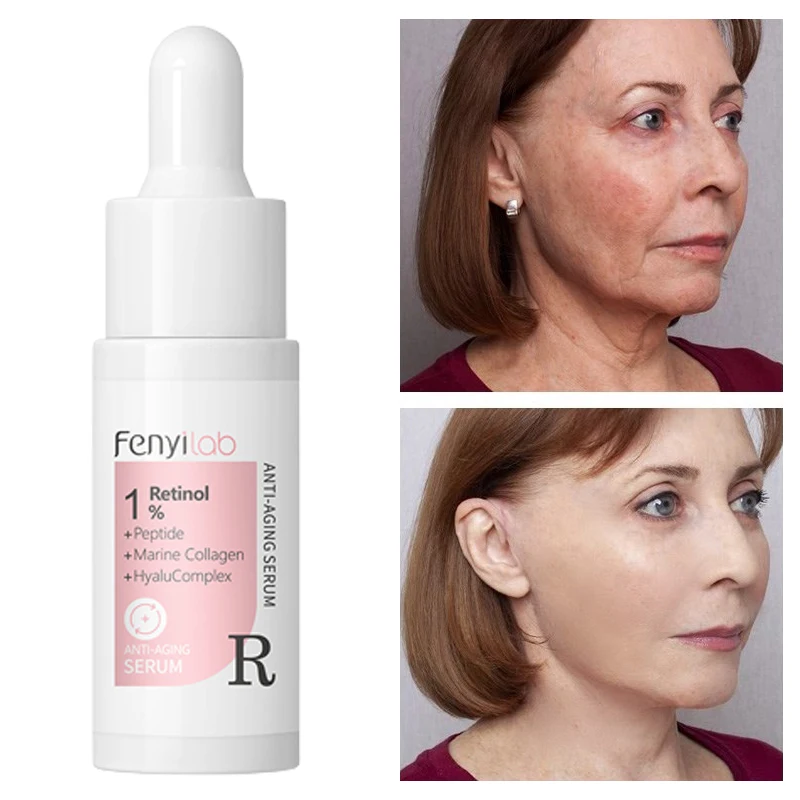 

Retinol Wrinkle Removal Face Serum Anti-Aging Whitening Essence Remove Dark Spots Shrink Pores Firming Korea Skin Care Products