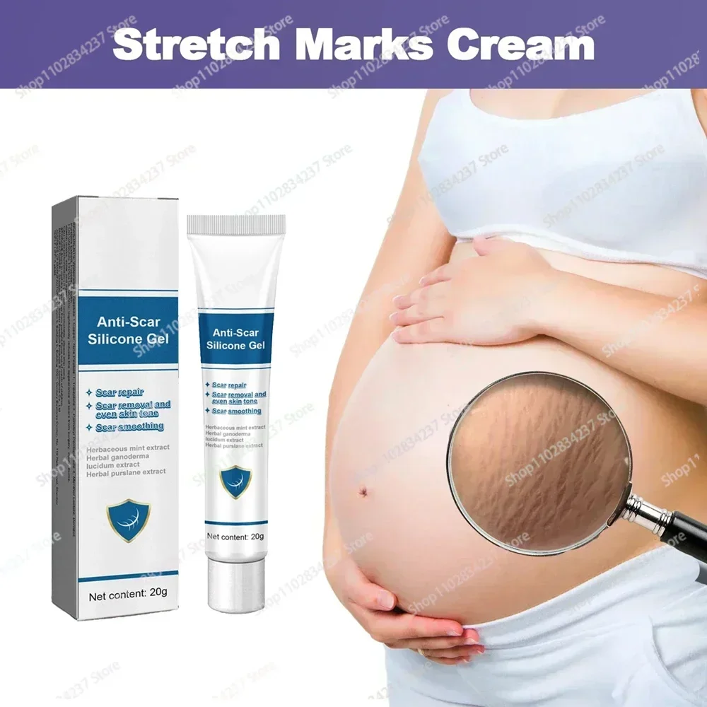 

Stretch Mark Remover Permanent Stretch Mark Removerstretch marks remove scars