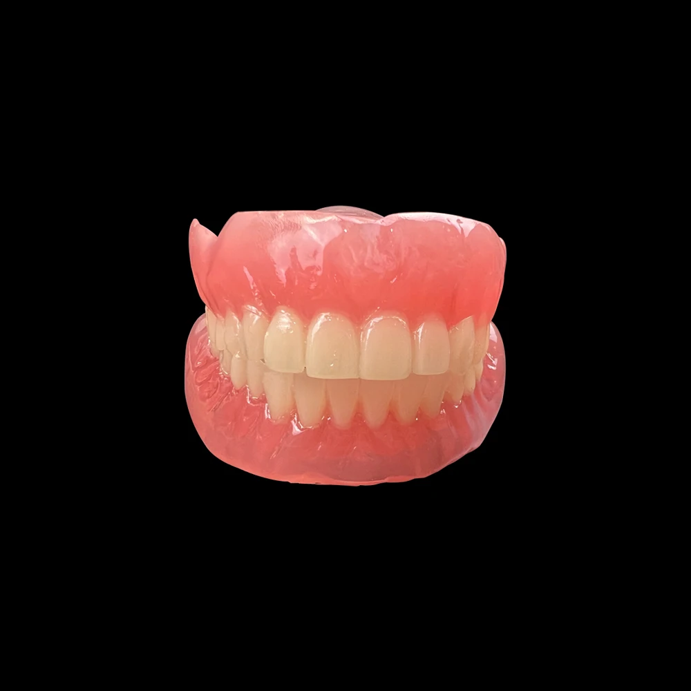 Dental Implant Model Removable Upper/Mandibular Model with 4 Implants Research Overdenture For Dentist Teaching training Demo