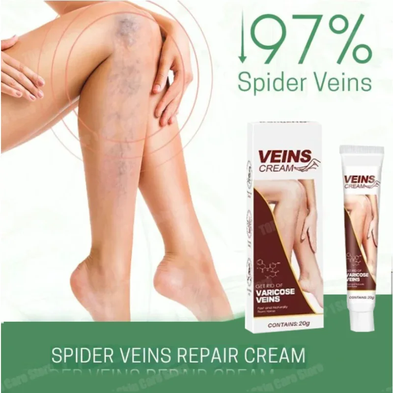 ⁿⁱᶜᵉ Varicose Vein Treatment Leg Vein Health Ointment, Effectively Removing Spider Veins2210