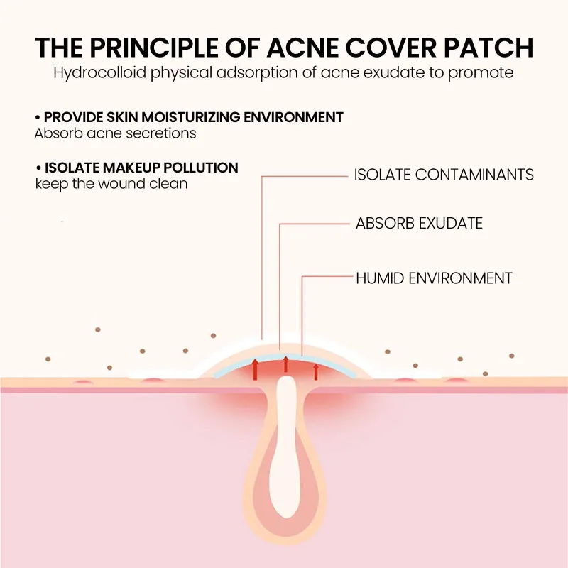 Invisible Pimple Patch Invisible Makeup Clarifying Pimple Patch Closed Circles Acne Fade Pimple Marks Waterproof Moisturising